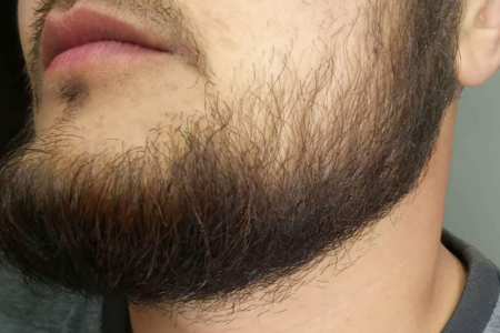 t_beard.jpeg