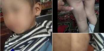 В Алае супруги жестоко избивали 3-летнего племянника, которого бросила мать